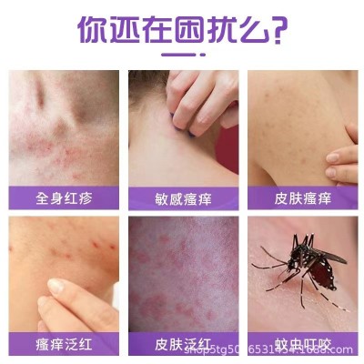 现货紫花地丁益菌透皮膏瘙痒芷痒乳膏批发代发蚊虫叮咬紫花地丁膏图3